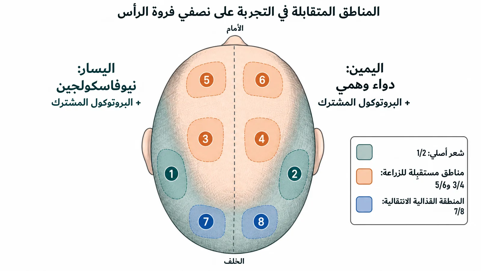 خريطة مواضع التجربة المعمّاة على نصفي فروة الرأس: مناطق متقابلة من 1 إلى 8، الجانب الأيسر يتلقى النيوفاسكولجين والأيمن الدواء الوهمي