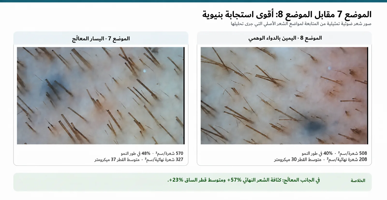 صور الشعر الضوئية في المتابعة للموضع 7 المعالَج والموضع 8 بالدواء الوهمي: 570 مقابل 508 شعرة في السنتيمتر المربع، ومتوسط قطر 37 مقابل 30 ميكرومتر