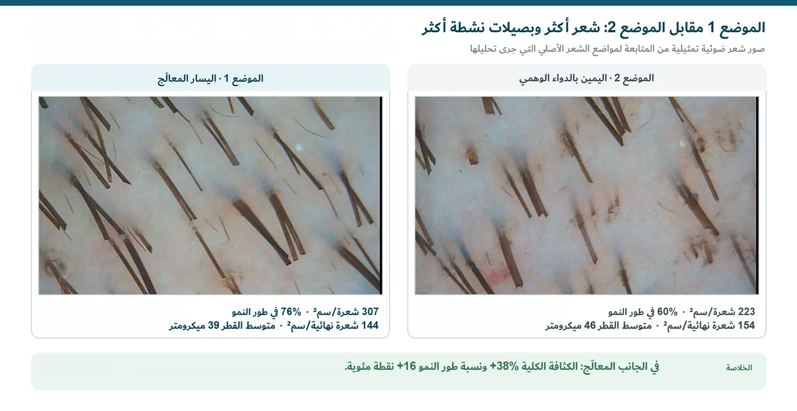 صور الشعر الضوئية في المتابعة للزوج الصدغي الجداري: الموضع 1 المعالَج والموضع 2 بالدواء الوهمي