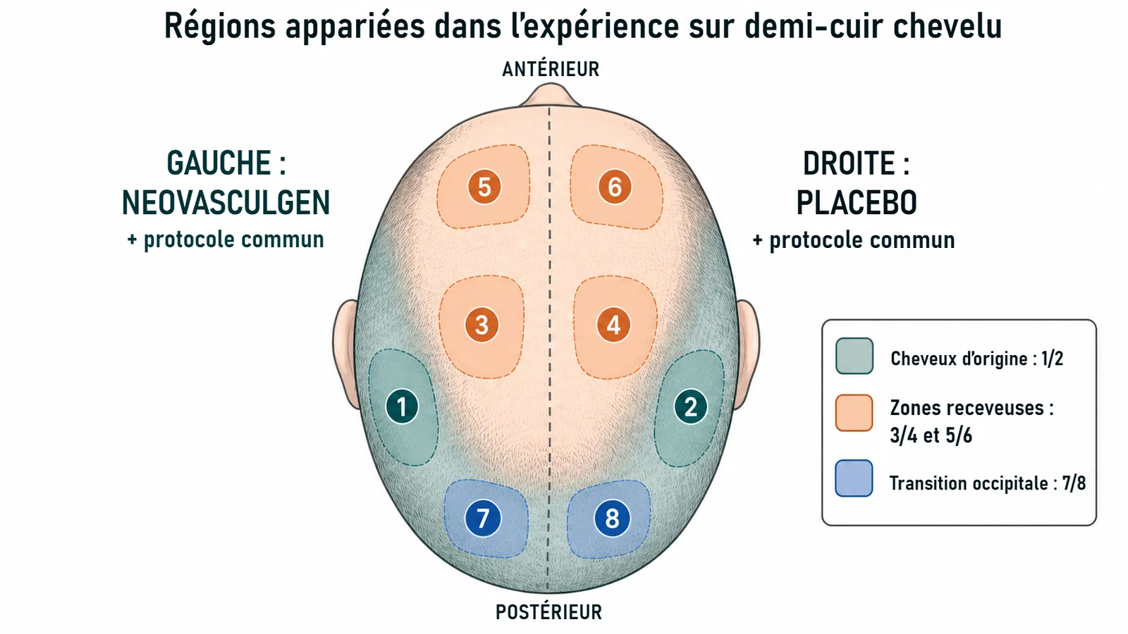 Carte des sites de l’expérience en aveugle sur un demi-cuir chevelu : régions appariées 1 à 8, le côté gauche recevant le Neovasculgen et le côté droit le placebo