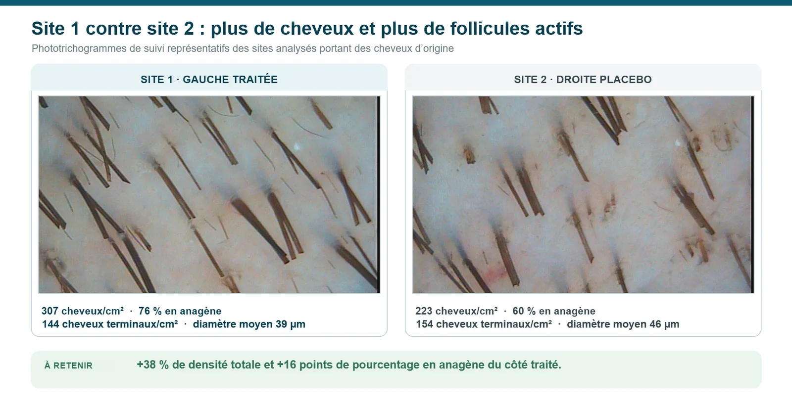 Phototrichogrammes de suivi de la paire temporo-pariétale : site 1 traité et site 2 placebo