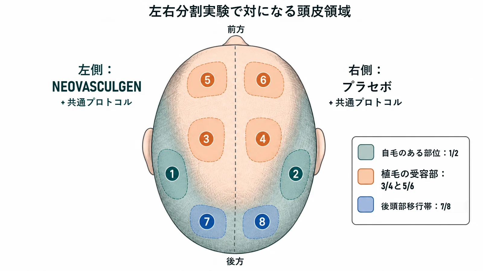 盲検下の左右分割実験の部位マップ。1から8の対になる頭皮領域で、左側はNeovasculgen、右側はプラセボ