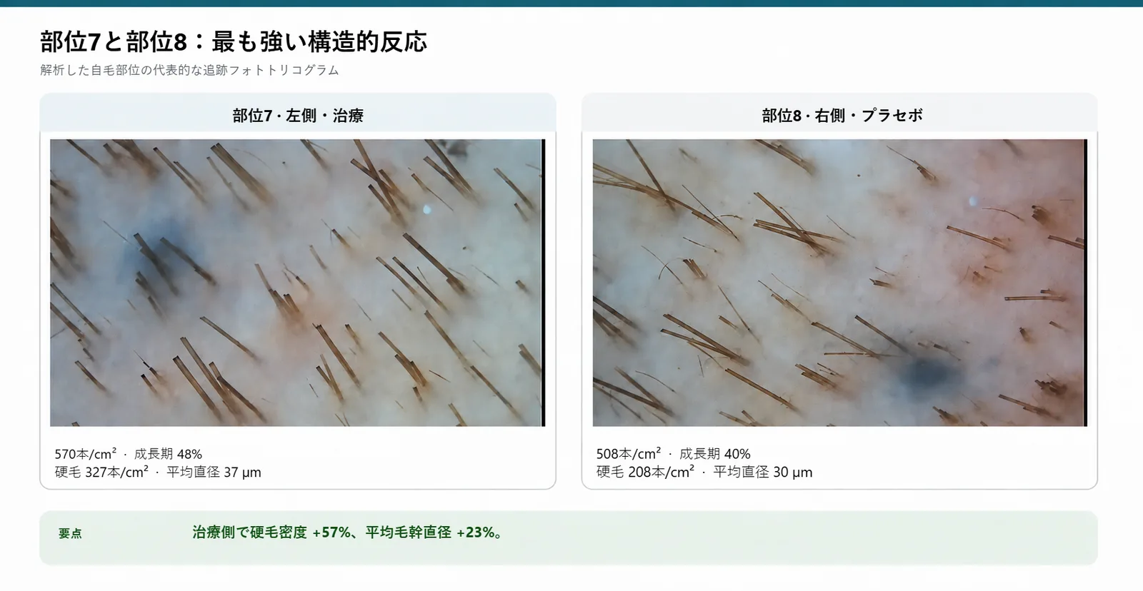 部位7（治療）と部位8（プラセボ）の追跡フォトトリコグラム。1平方センチあたり570本対508本、平均直径37 μm対30 μm