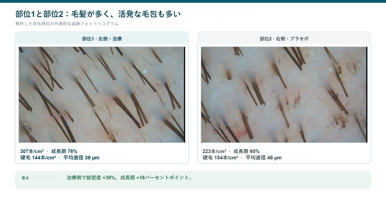 側頭頭頂部の一対の追跡フォトトリコグラム。部位1が治療側、部位2がプラセボ側