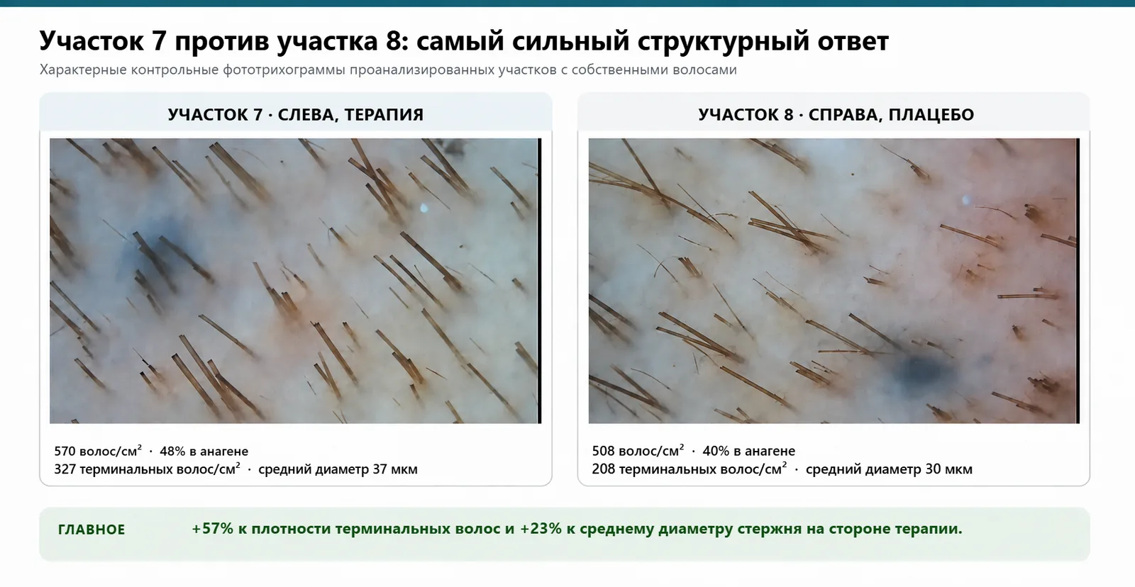 Контрольные фототрихограммы участка 7, терапия, и участка 8, плацебо: 570 против 508 волос на квадратный сантиметр и 37 против 30 микрометров среднего диаметра