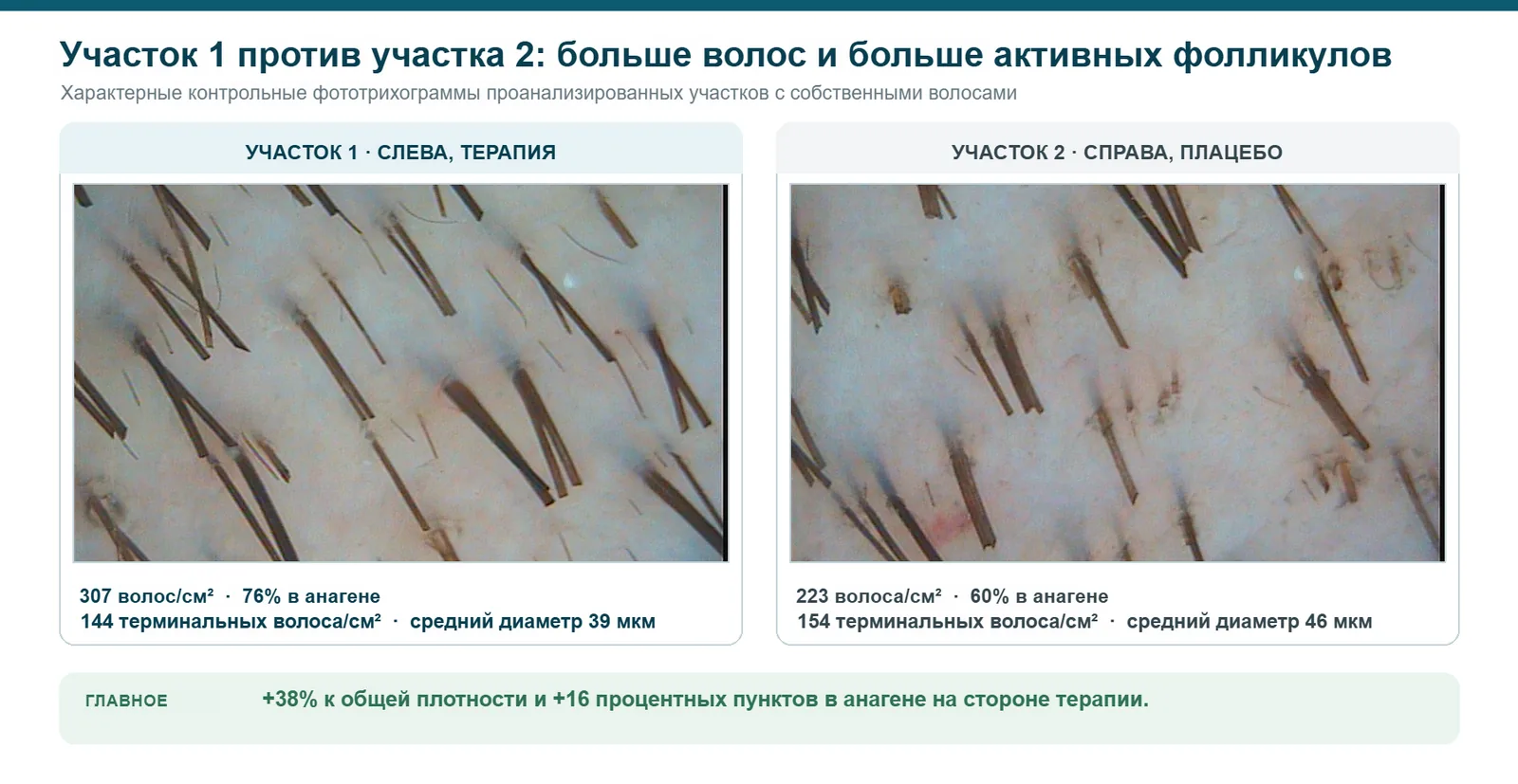 Контрольные фототрихограммы височно-теменной пары: участок 1, терапия, и участок 2, плацебо