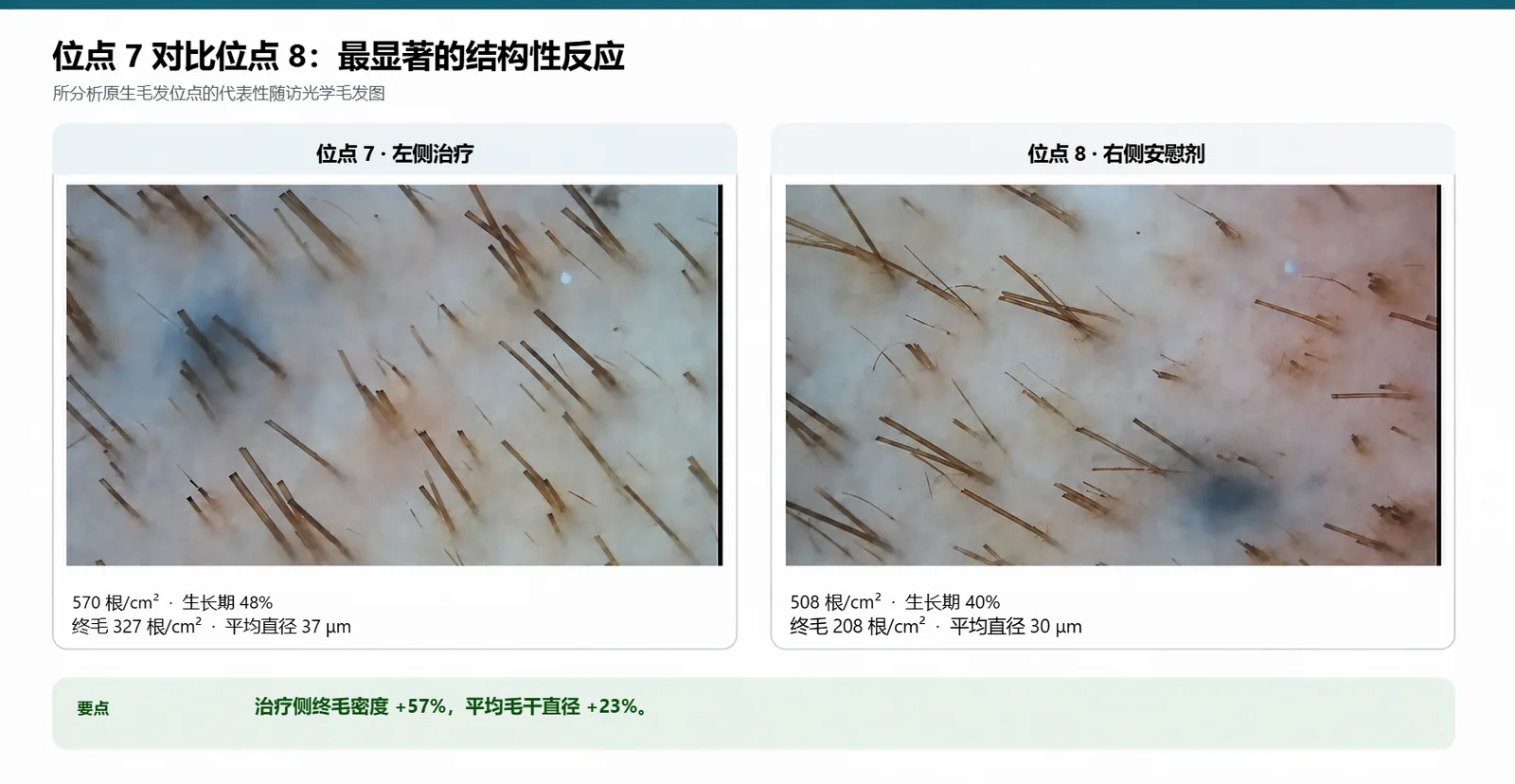 位点 7（治疗）和位点 8（安慰剂）的随访光学毛发图：每平方厘米 570 根对 508 根，平均直径 37 μm 对 30 μm